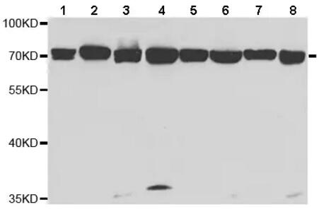Anti-Annexin-6/ANXA6抗体