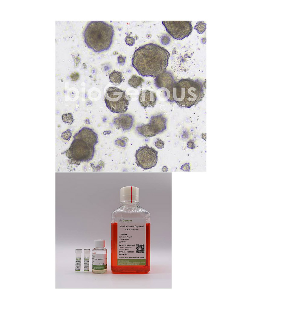 Cervical cancer Organoid Kit宫颈癌