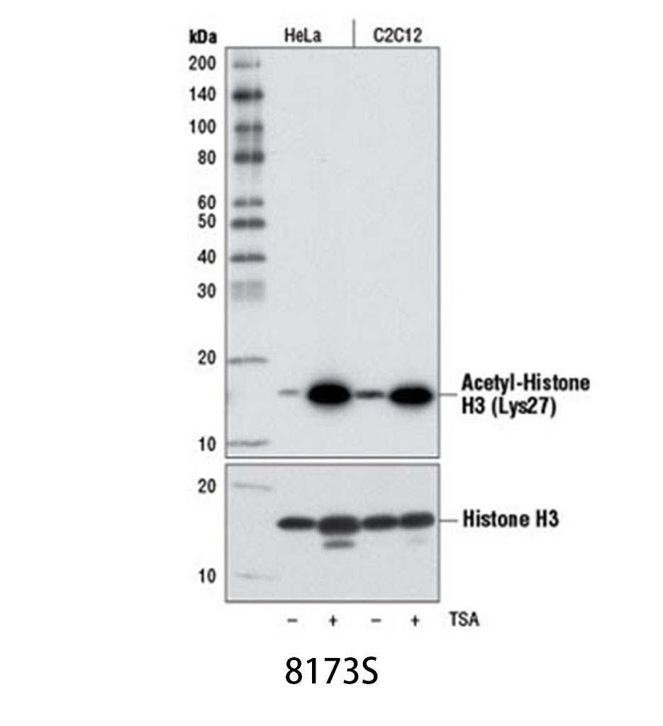 Acetyl-Histone H3 (Lys27) (D5E4) XP Rabbit mAb