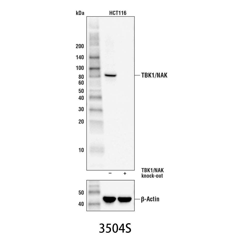 TBK1/NAK (D1B4) Rabbit mAb