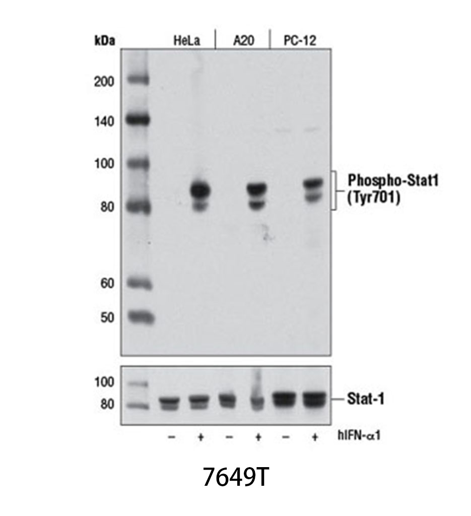 Phospho-Stat1 (Tyr701) (D4A7) Rabbit mAb