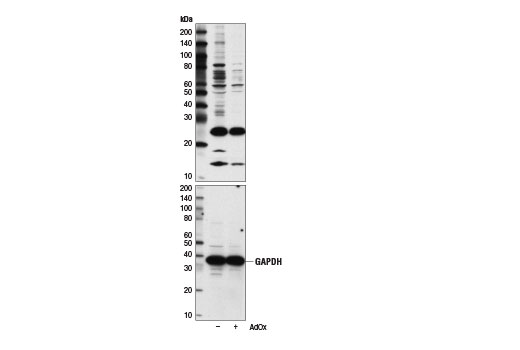 Symmetric Di-Methyl Arginine Motif [sdme-RG] MultiMab Rabbit mAb mix