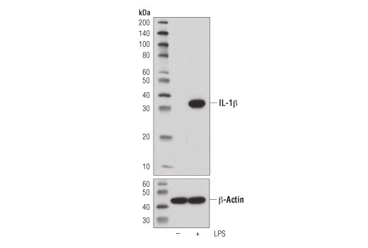 IL-1β (D6D6T) Rabbit mAb (Mouse Specific)