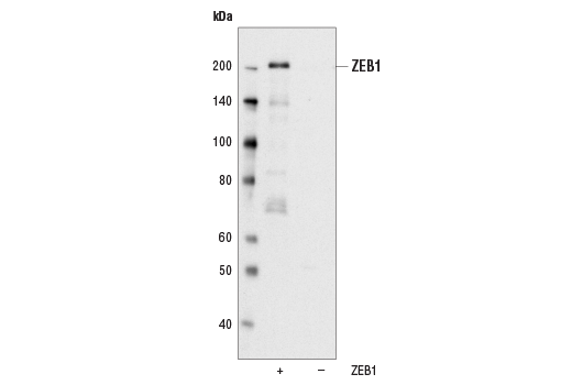 ZEB1 (D80D3) Rabbit mAb