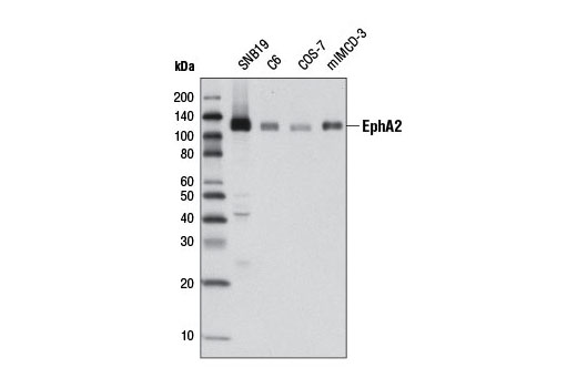 EphA2 (D4A2) XP Rabbit mAb