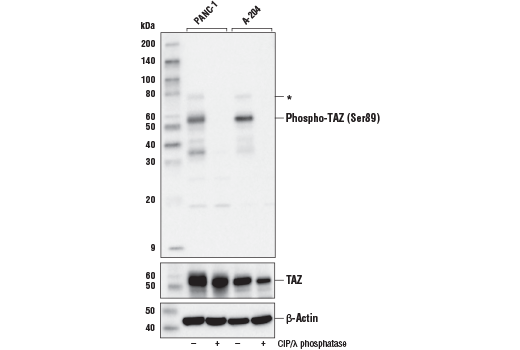 Phospho-TAZ (Ser89) (E1X9C) Rabbit mAb
