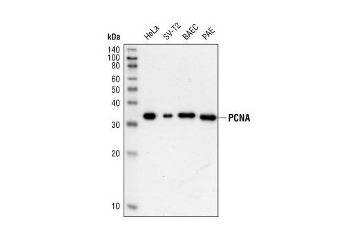 PCNA (PC10) Mouse mAb