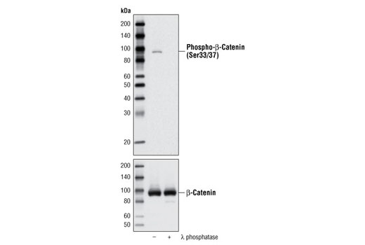 Phospho-β-Catenin (Ser33/37) Antibody