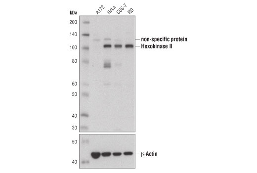Hexokinase II (C64G5) Rabbit mAb