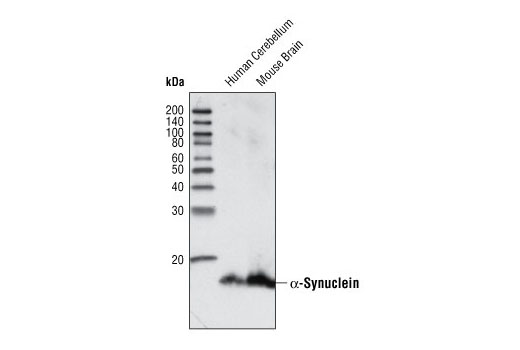 α-Synuclein Antibody (IF Preferred)