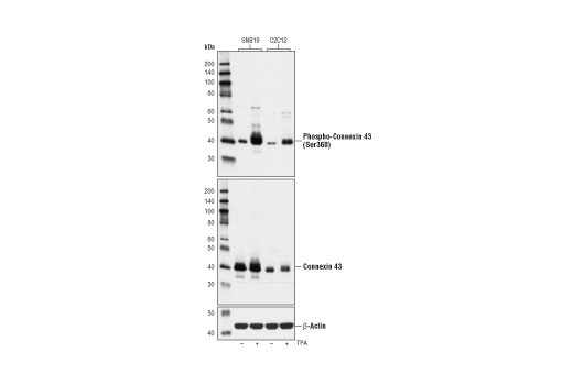 Phospho-Connexin 43 (Ser368) (D6W8P) Rabbit mAb