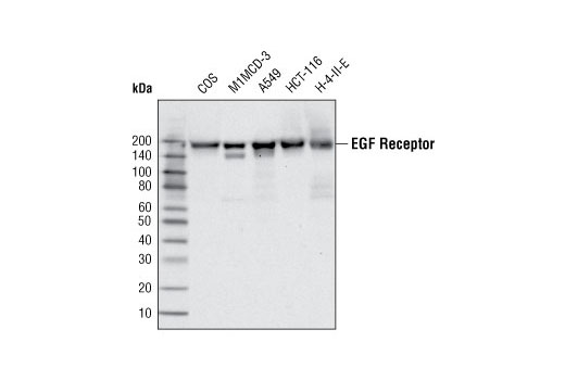 EGF Receptor (C74B9) Rabbit mAb