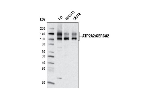 ATP2A2/SERCA2 (D51B11) Rabbit mAb