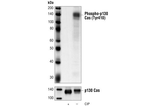 Phospho-p130 Cas (Tyr410) Antibody