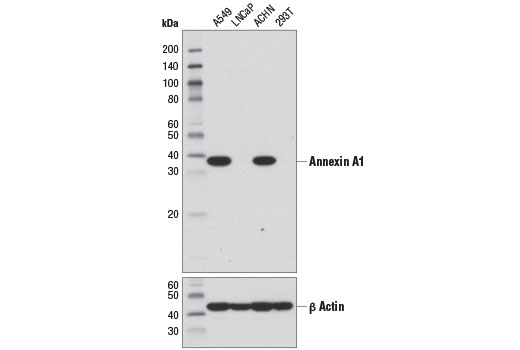 Annexin A1 (D5V2T) XP Rabbit mAb