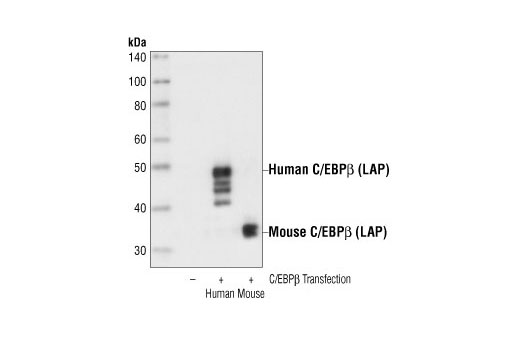 C/EBPβ (LAP) Antibody