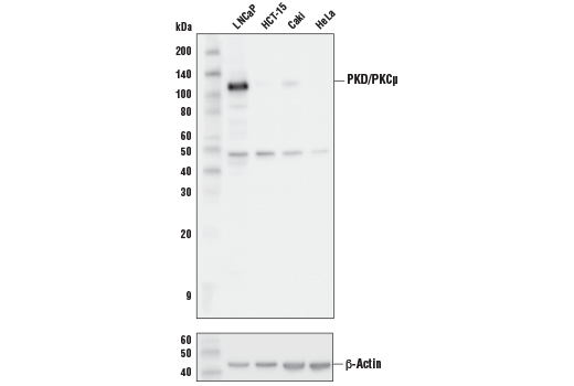 PKD/PKCμ (D4J1N) Rabbit mAb