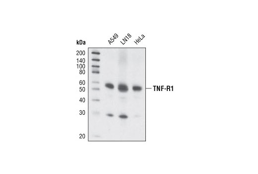 TNF-R1 (C25C1) Rabbit mAb