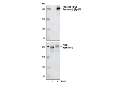 PDGF Receptor β Antibody Sampler Kit