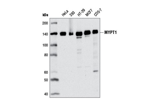 Calcium Ion Regulation Antibody Sampler Kit