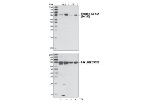 Phospho-p90RSK (Ser380) Antibody