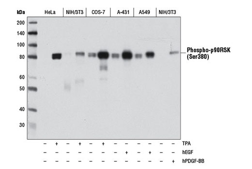 Phospho-p90RSK (Ser380) (D5D8) Rabbit mAb