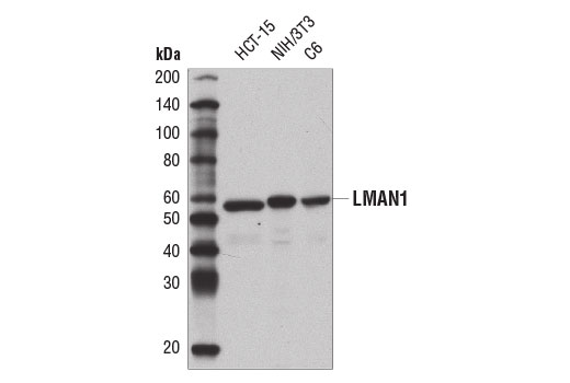 LMAN1 (E2B6H) Rabbit mAb