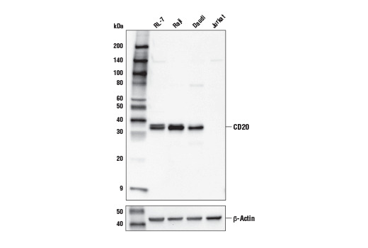 CD20 (E7B7T) XP Rabbit mAb