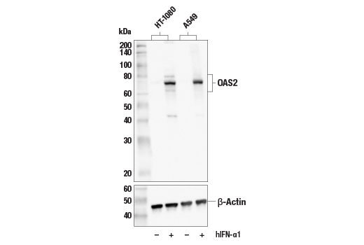 OAS2 (E2G4K) Rabbit Monoclonal Antibody