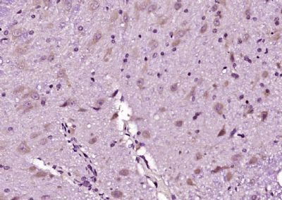 BCL2相互作用蛋白质抗体