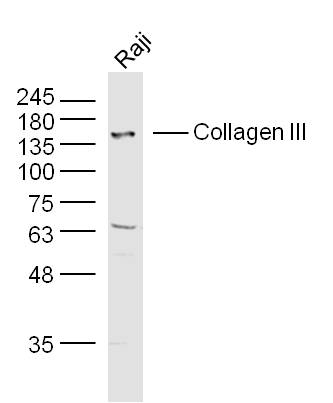 Ⅲ型胶原蛋白/胶原蛋白3/3型胶原蛋白/III型胶原抗体