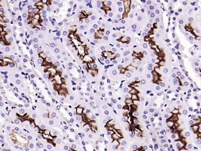 血管紧张素转换酶2抗体