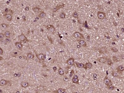 Toll样受体8抗体