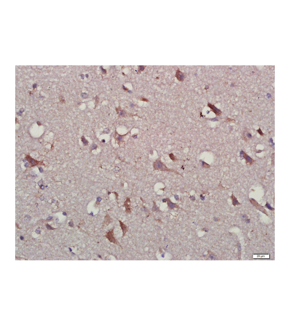 白细胞介素-10抗体