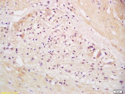 早期内吞体相关蛋白1抗体