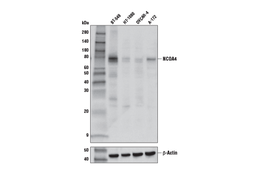 NCOA4 (E8H8Z) Rabbit mAb