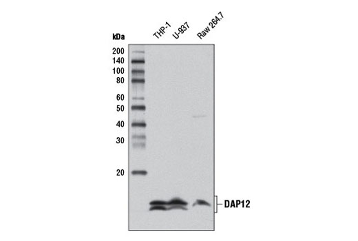 TREM2 Signaling Pathways Sampler Kit
