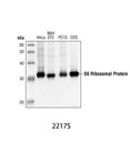 S6 Ribosomal Protein (5G10) Rabbit mAb