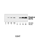Phospho-p53 (Ser15) Antibody