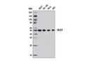 Tricarboxylic Acid Cycle Antibody Sampler Kit