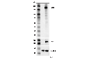 Cas9 (<i>S. pyogenes</i>) (D8Y4K) Rabbit mAb