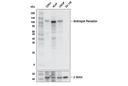 Androgen Receptor (E3S4N) Rabbit mAb (Carboxy-terminal Antigen)
