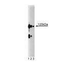 CASK Pure 7/CASK 50ug