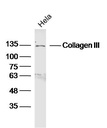 Ⅲ型胶原蛋白/胶原蛋白3/3型胶原蛋白抗体
