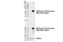 SARS-CoV-2 Nucleocapsid Protein (HL344) Rabbit mAb